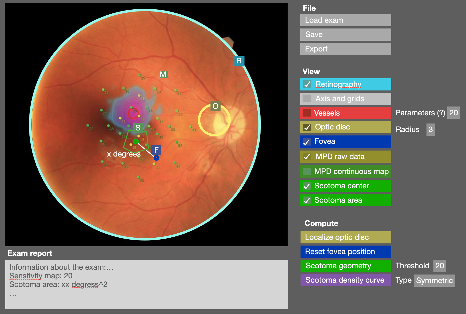 A first version of the microperimetry analysis software. On the left, is displayed a microperimetry exam (i.e., a retinography (image of a retina) surimposed with a functional measurement of the visual field light sensitivity). On the right, the user can choose between several options to automatically analyse the image and extract relevant exam measures.