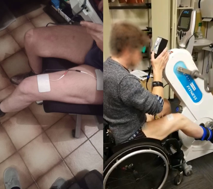 Muscular training for overground cycling. Left: Participant executing strengthening program with conventional multichannel stimulator (CEFAR); Right: Participant performing endurance training on FES-ergocycle.