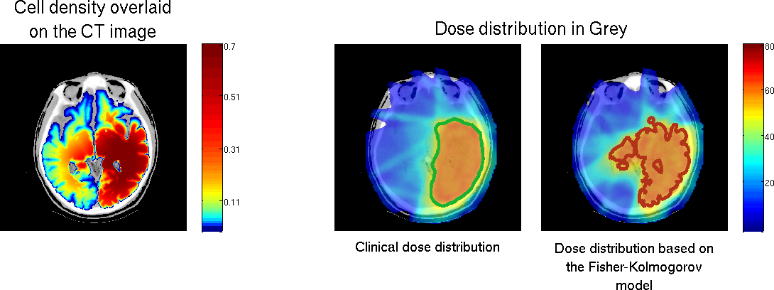 IMG/dose_distribution.png