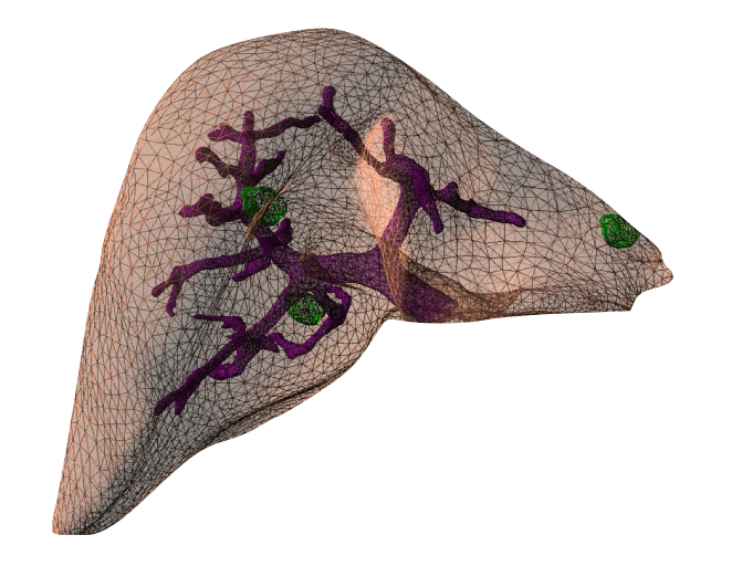 IMG/Liver-vessels.png