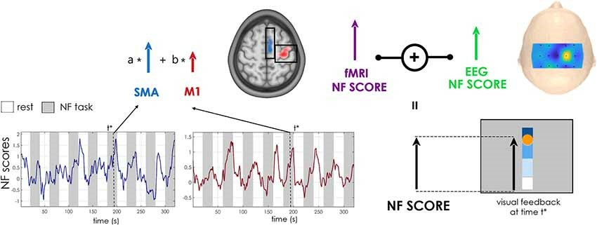 Results of our pilot study on Neurofeedback for stroke patients.