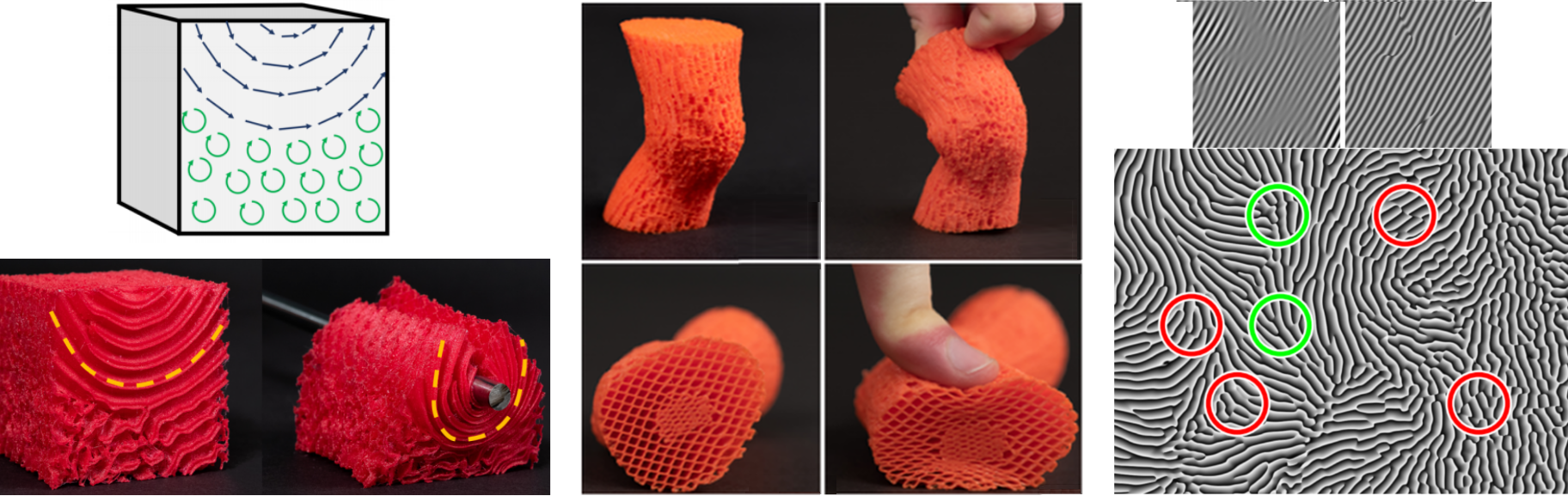 Left: Specification of the volumetric amount and direction of anisotropy, and result on a real 3D printed object. Middle: Example of a knee, which can only bend as expected, and reproducing the rigid bones. Right: Two types of discontinuitie appearing when turning Gabor noise into Phasor noise, that we needed to sweep away to produce a seemless microstructure.Video: https://www.youtube.com/watch?v=RBQ4y6VGQO8
