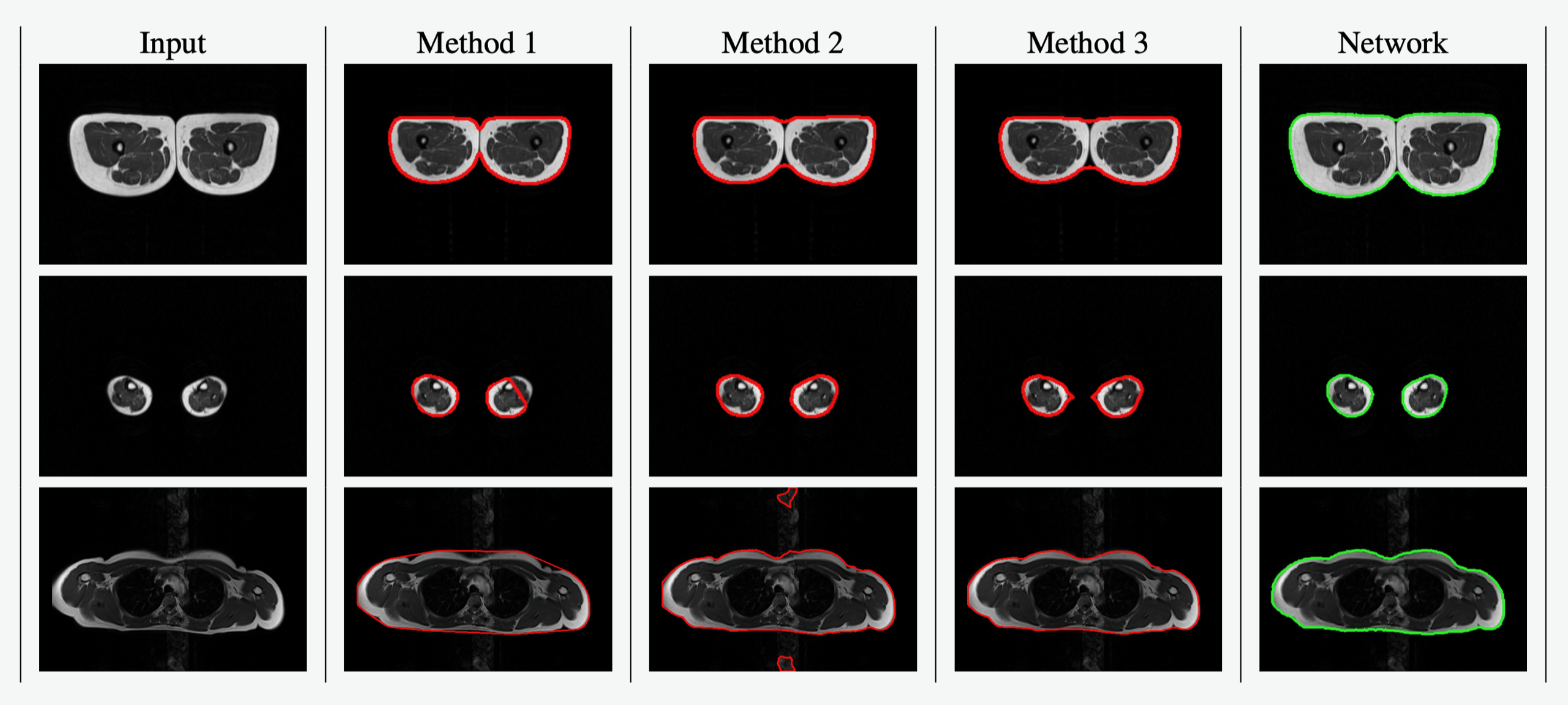 Given an MRI image, different methods obtain different segmentation candidates with good results on some configurations and errors in others. The contours of the candidate segmentations are shown in red over the input image. The trained GENTEL network gathers the right knowledge in a unified framework.