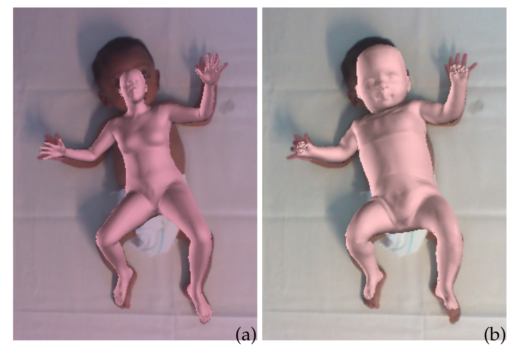 (a) Simply scaling a generic adult body model and fitting it to an infant does not work as body proportions significantly differ. (b) The proposed SMIL model properly captures the infants’ shape and pose