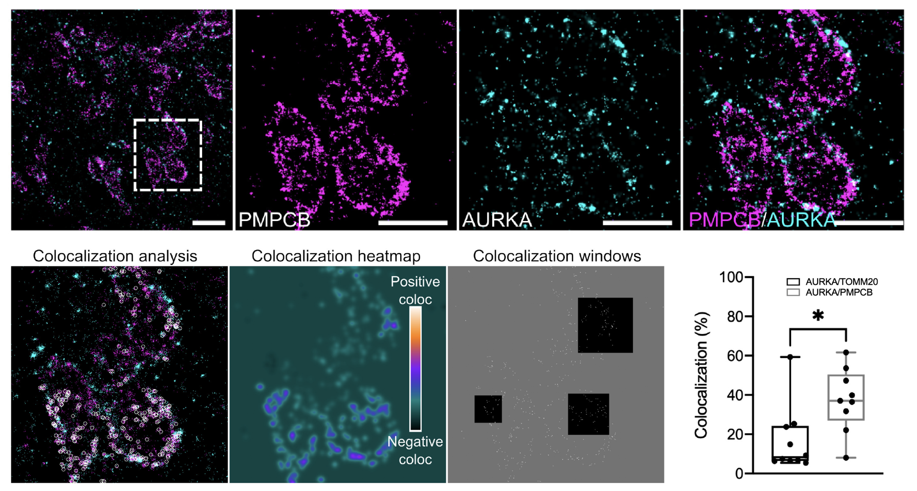 AURKA colocalizes with PMPCB in methanol-fixed cells. Top: Maximal projections of representative 2D dSTORM micrographs from MCF7 co-stained for AURKA and PMPCB (B).
The anti-PMPCB primary antibodies was detected using secondary antibodies conjugated to Alexa647 and pseudocolored magenta, while the anti-AURKA primary antibody was detected using a secondary antibody conjugated to Alexa555 and pseudocolored cyan. For the protein pair, the dotted area in the left panels indicates the magnified region where each staining is shown individually (middle panels), or merged (right panels). Scale bar: 2μm (left) or 1μm (middle and right panels). Bottom: (left panel) Visual representation of positive (white rounds) colocalization sites on the magnified area of AURKA/PMPCB micrographs; (middle panel) Colocalization heatmap ranging from yellow (positive colocalization) to black (negative colocalization), and background (colocalization score arbitrarily set to 0) in green; (right panel). Three representative colocalization windows of 64×6464 \times 64 pixels, 96×9696 \times 96 pixels and 128×128128 \times 128 pixels superimposed over 3 representative positions. For each position, a window center is drawn in the set of super-localizations of the reference
channel, and labeled as a white spot which is used for colocalization. All windows centers are shown; (statistics panel) Quantification of the percentage of colocalization for the indicated protein pairs. Data range from min to max. Dots correspond to individual cells issued from n=3n = 3 independent experiments. * P <0.05.