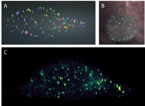 Visualization of Endosomes (Rab5) in Hela Cells. (A) Endosomes visualization using Morphonet. (B) Endosomes observed in VR. (C) Raw data of endosomes (Rab5).
