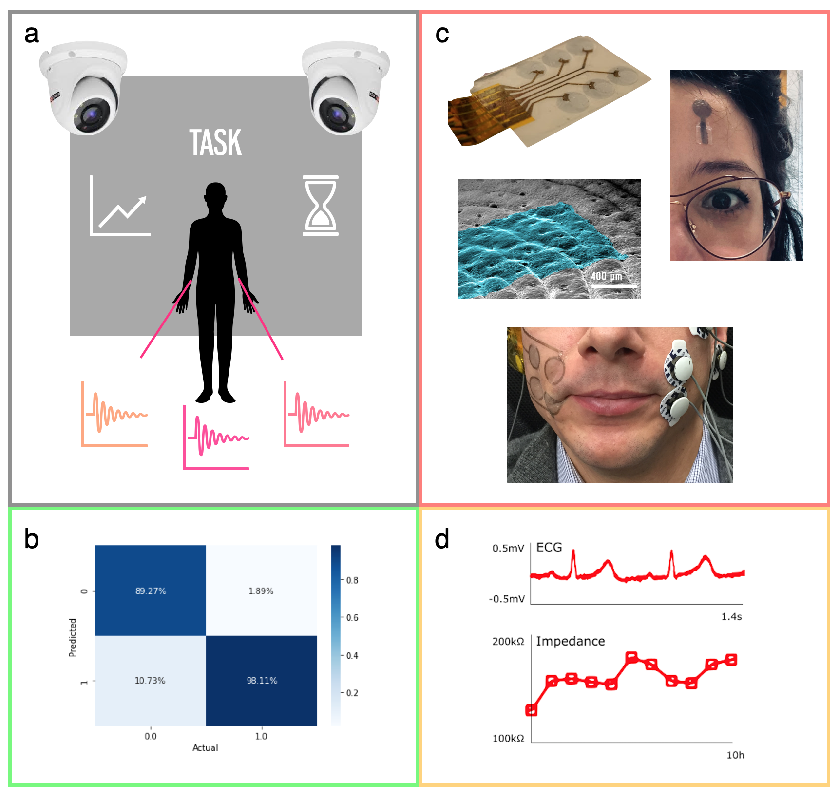 a. A representation of a UC for emotion recognition in our paradigm. b. Machine learning on biosignals, Classification of electroencephalography (EEG). c. Tattoo technology. From top, clockwise: Tattoo Multielectrodes array; a tattoo electrode on the forehead for EEG recording; tattoo and standard electrodes on the face for facial electromyography (fEMG); a tattoo substrate onto a skin replica. d. Biosignals acquired with tattoo in short- and long- term scenarios