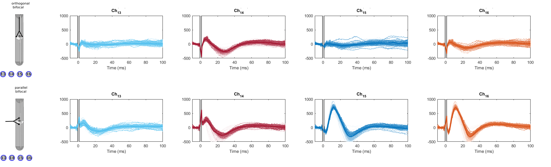 Recorded evoked potentials for contacts 13, 14, 15 and 16 with a 2.5mA intensity, 9Hz frequency, and biphasic stimulation pulse. A) Orthogonal configuration. B) Parallel configuration