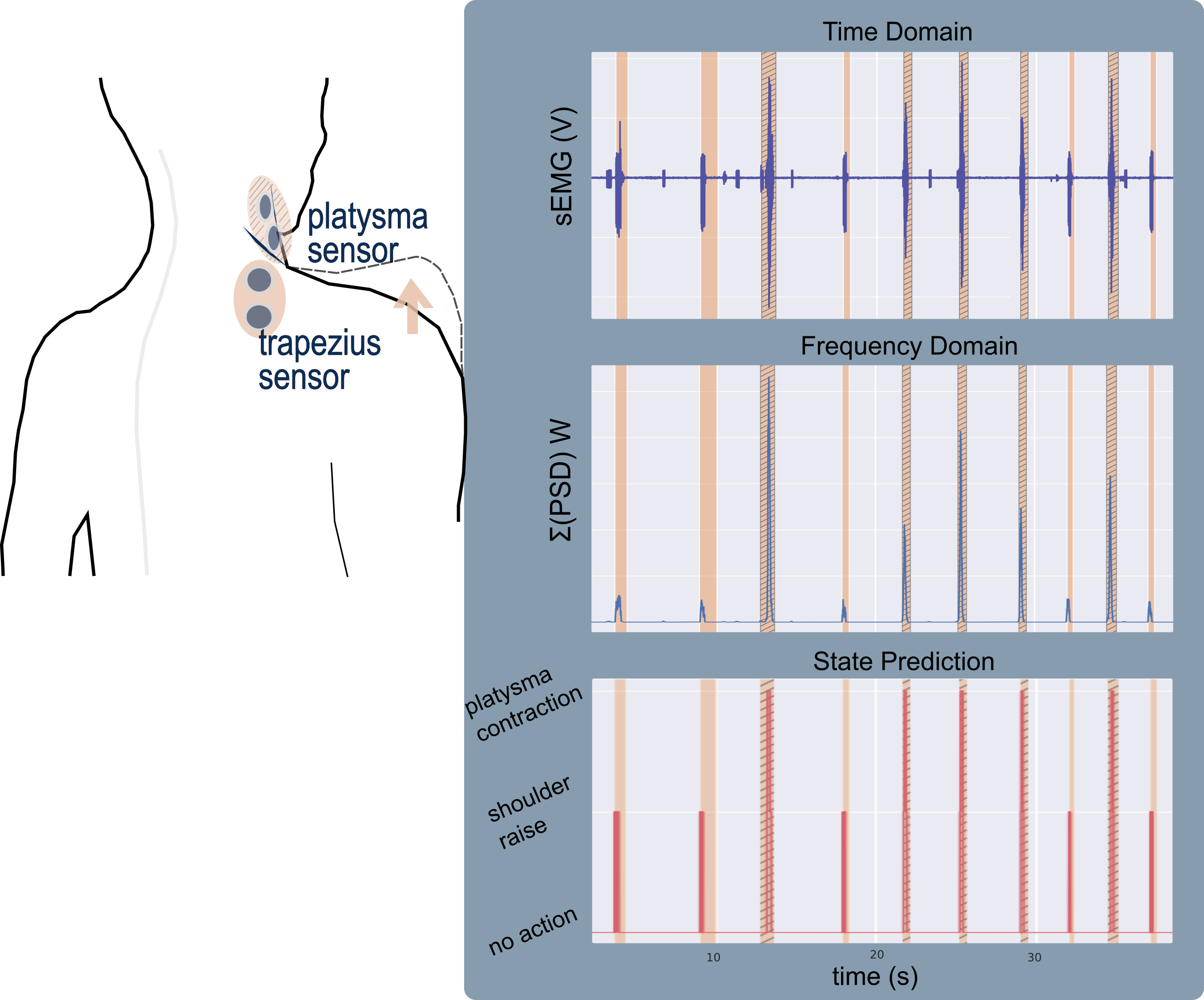 From top to bottom: The filtered EMG readings, the power of the signal and the state-prediction results from a data sample. The shaded regions represent the event occurrences; the hatched shaded regions indicate a platysma contraction and the non-hatched ones a shoulder raise.