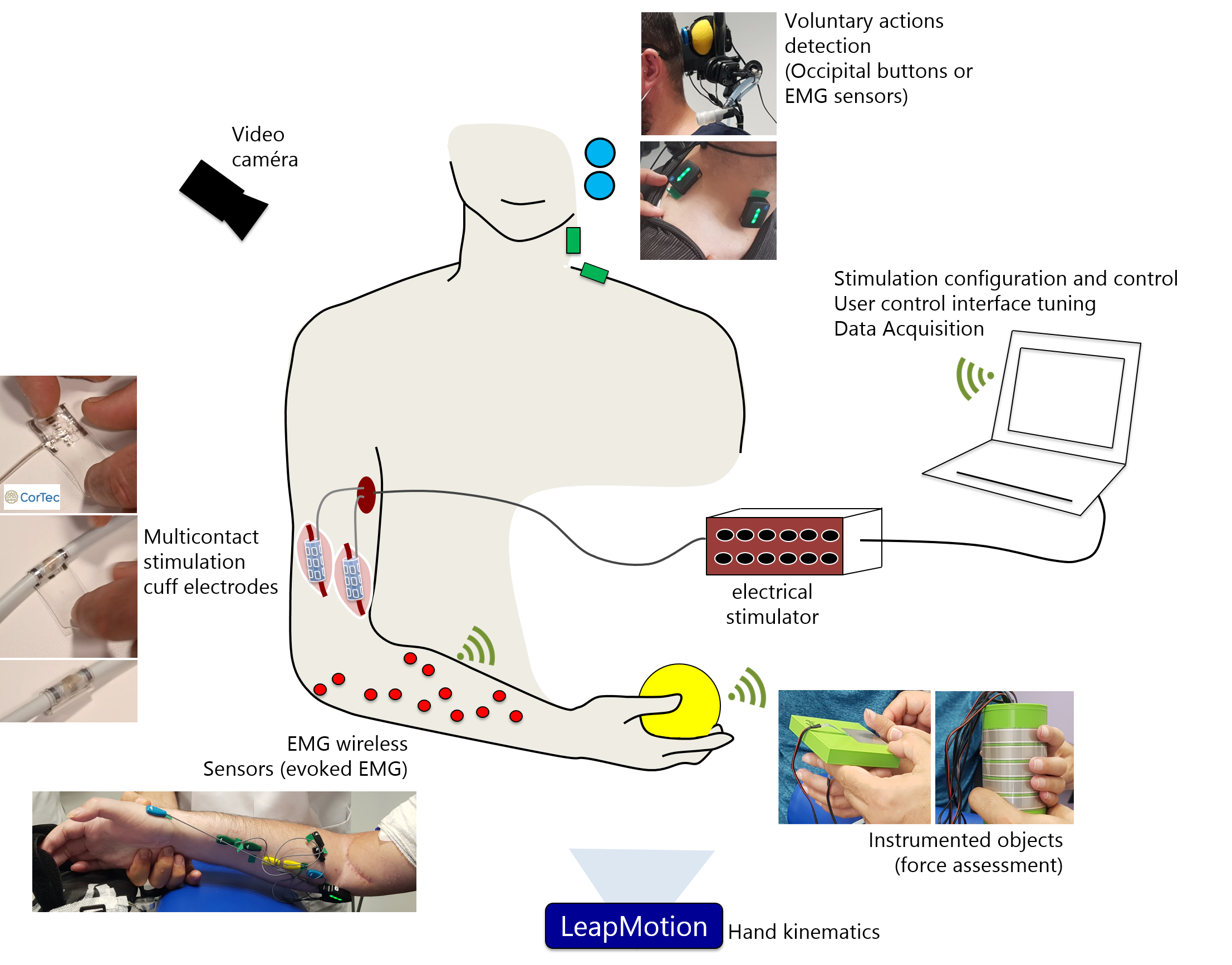 Setup description. An experimental platform was developed to control the stimulation delivered to 2 neural cuff electrodes implanted around the median and radial nerves. Evoked electromyography, video, evoked movement kinematics and grasping forces were recorded. The participants used voluntary muscle contractions or occipital buttons to trigger different stimulation configuration.