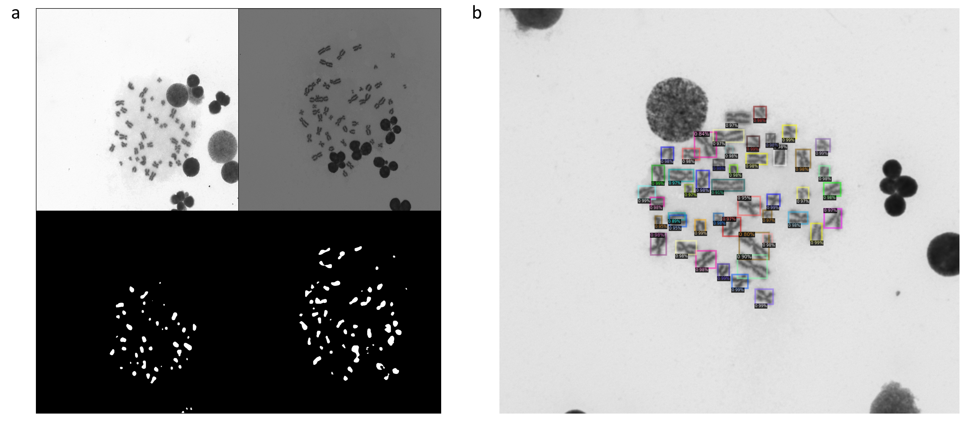 Localization of chromosomes in GIEMSA images.a, A pair of GIEMSA images and the segmentation maps by U-Net. b, The rectangles correspond to the chromosome locations predicted by Faster R-CNN. Each score is a class confidence metric.