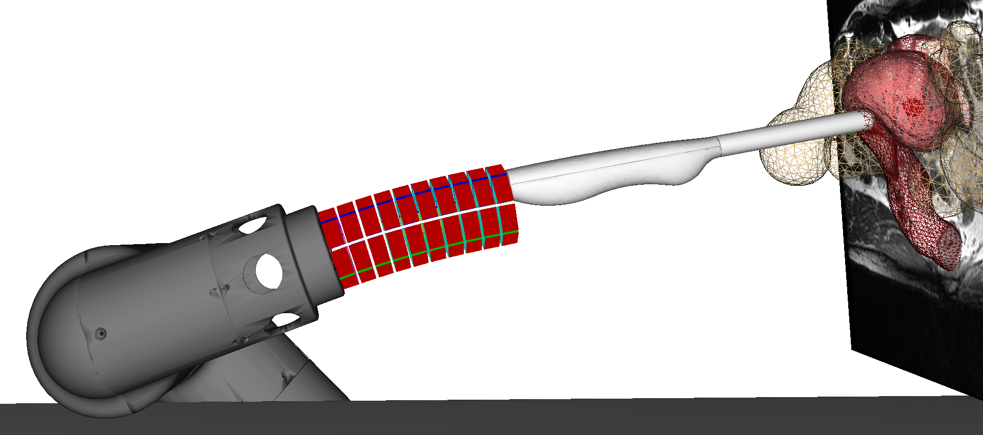 Image showing the simulation of on hybrid soft and rigid arm for prostate biopsy.