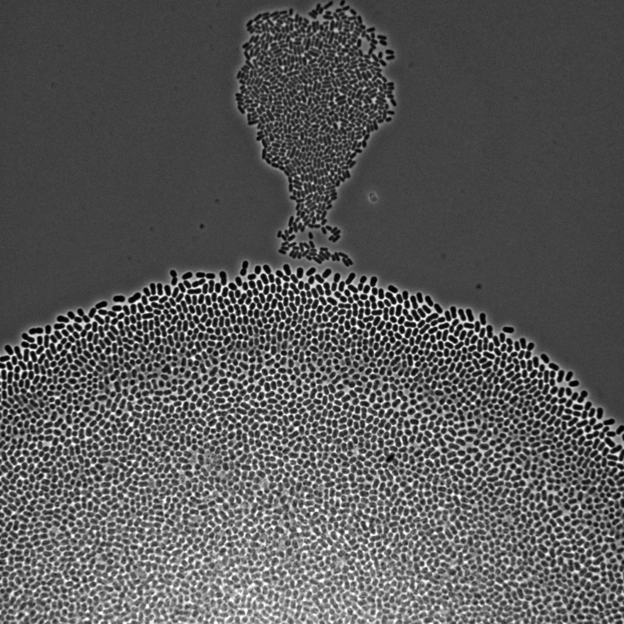 Figure 1: Microscopy image of Escherichia coli bacteria growing on a solid nutrient medium.