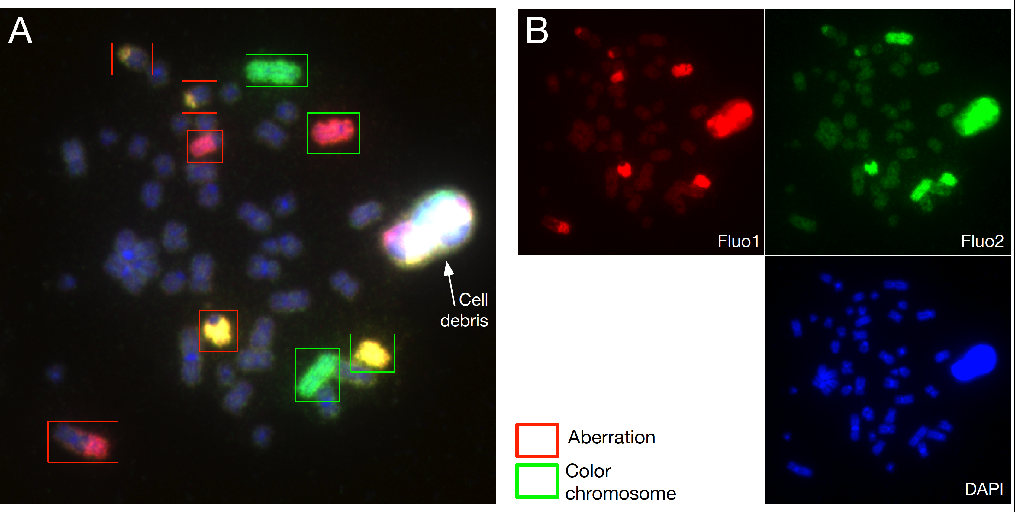 Translocation detection in three-channel FISH images. (A) The green rectangles indicate the location of "normal" chromosomes. The red rectangles correspond to the location of translocated chromosomes. (B) The three separated channels used to localize chromosomes and detect translocations.